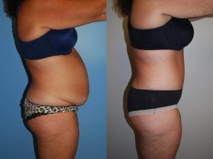 Before and After Image