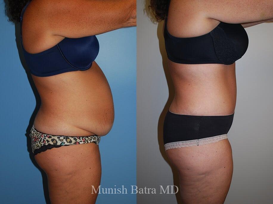 Before and After Image