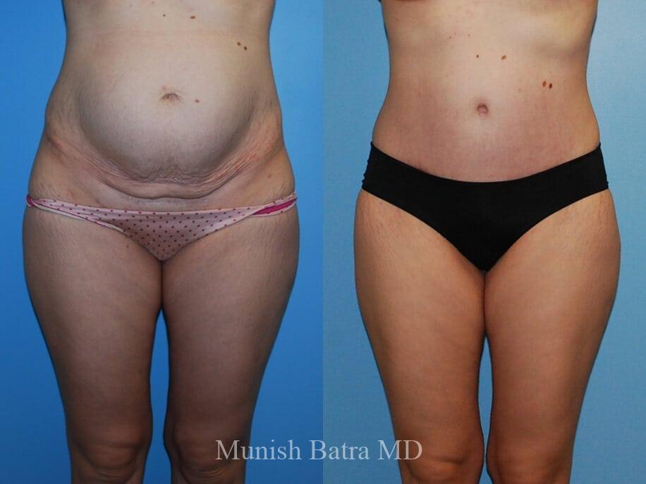 Before and After Image