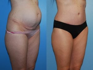 Before and After Image