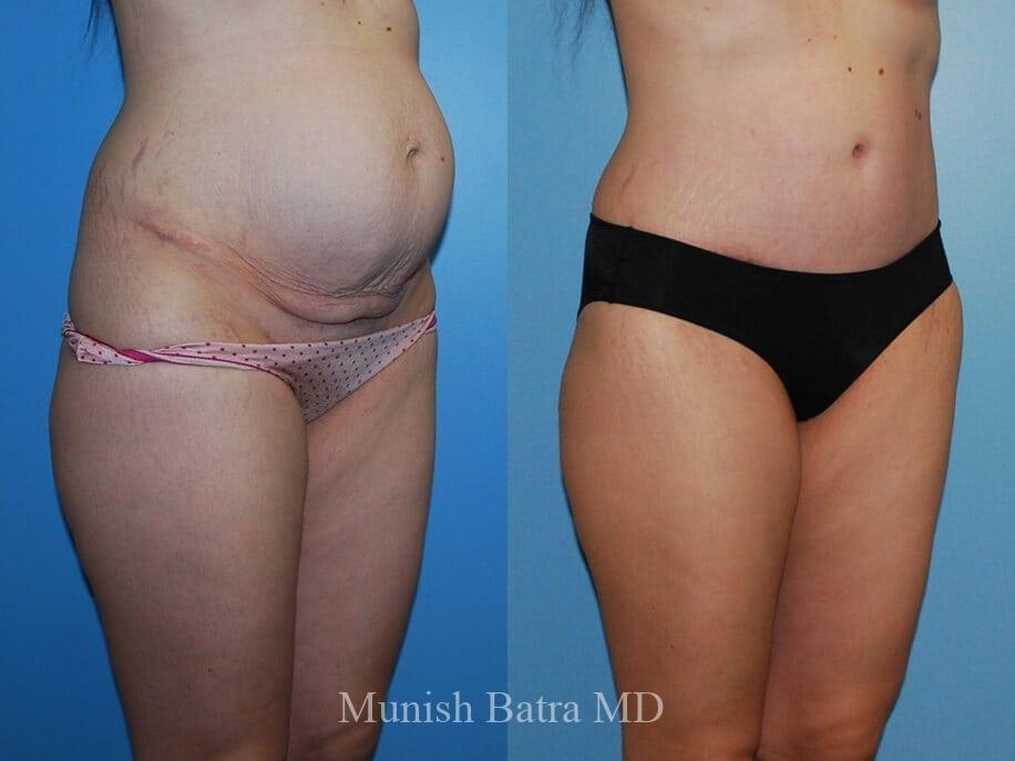 Before and After Image