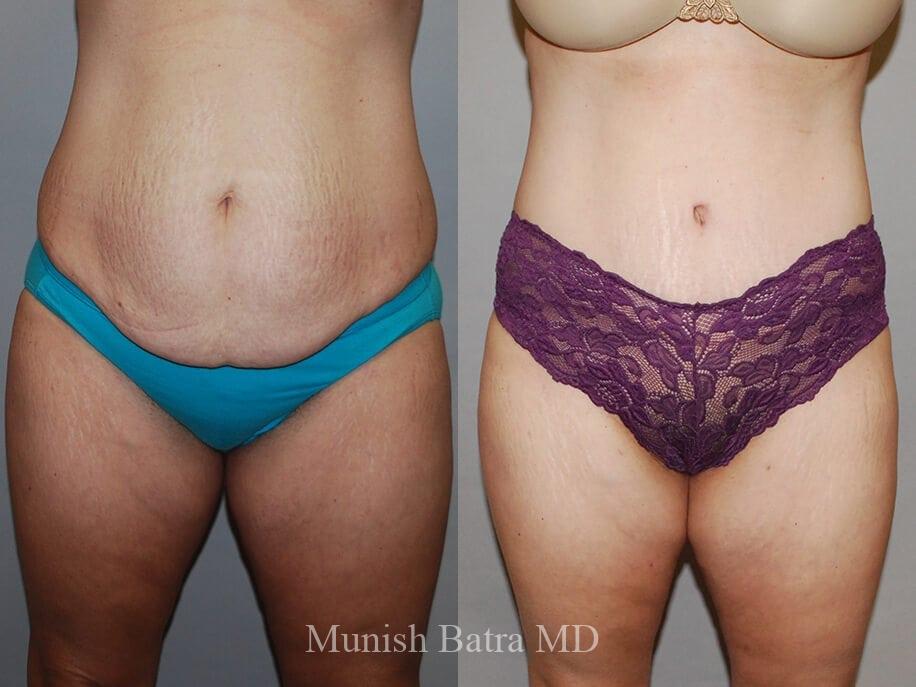 Before and After Image