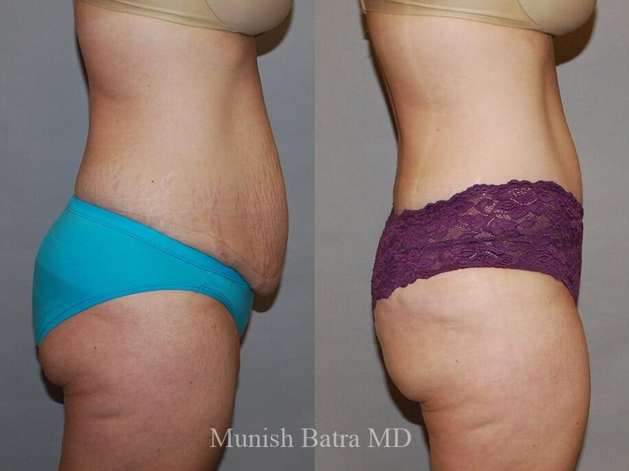 Before and After Image