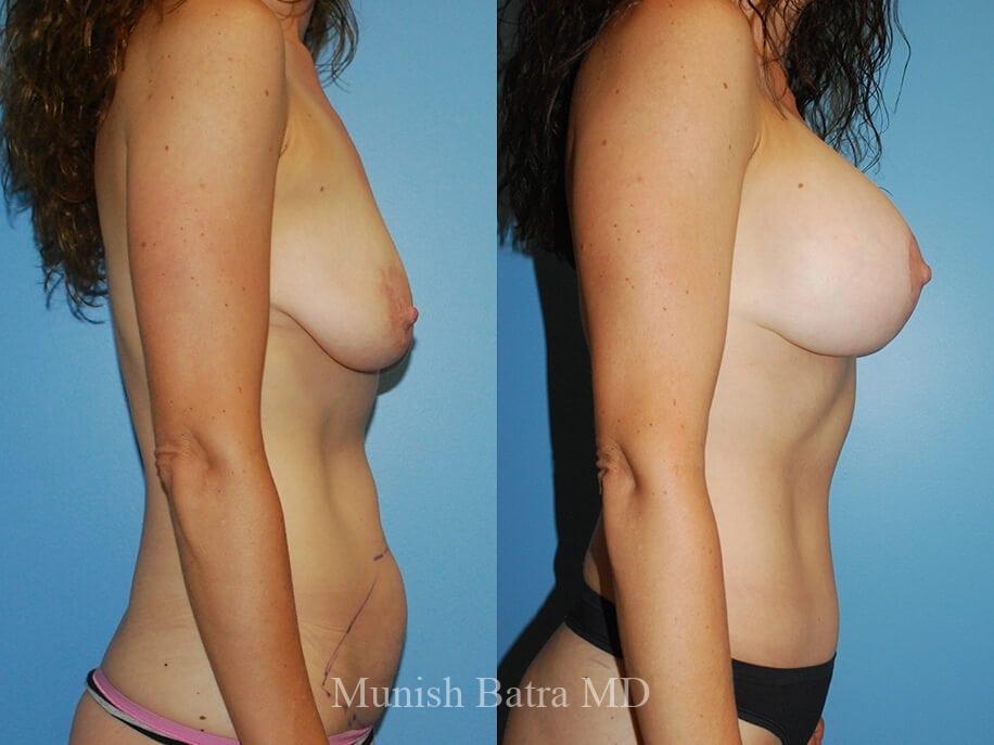 Before and After Image