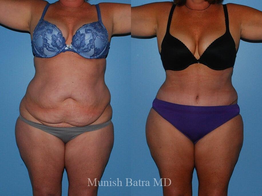Before and After Image
