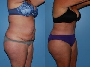 Before and After Image