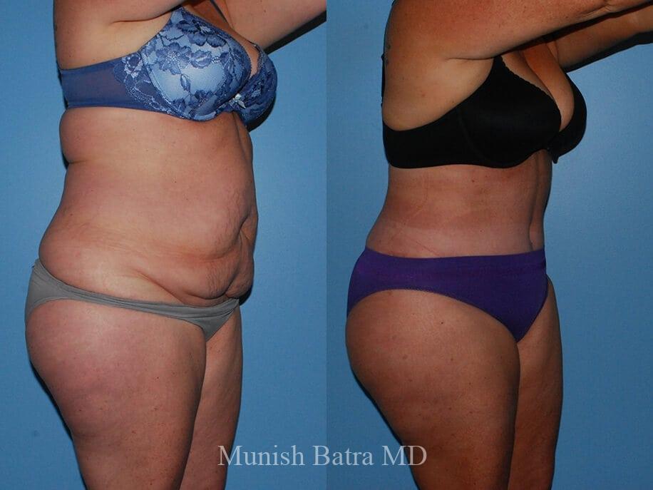 Before and After Image