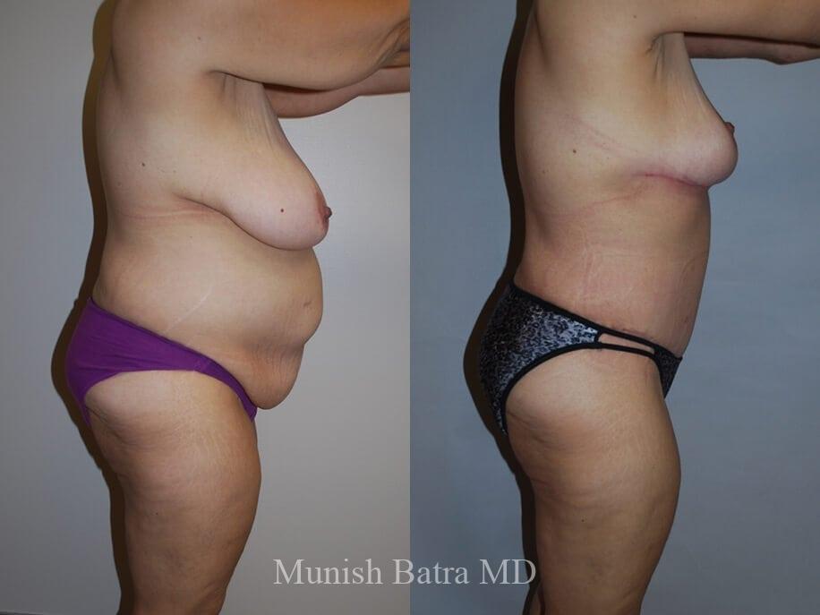 Before and After Image