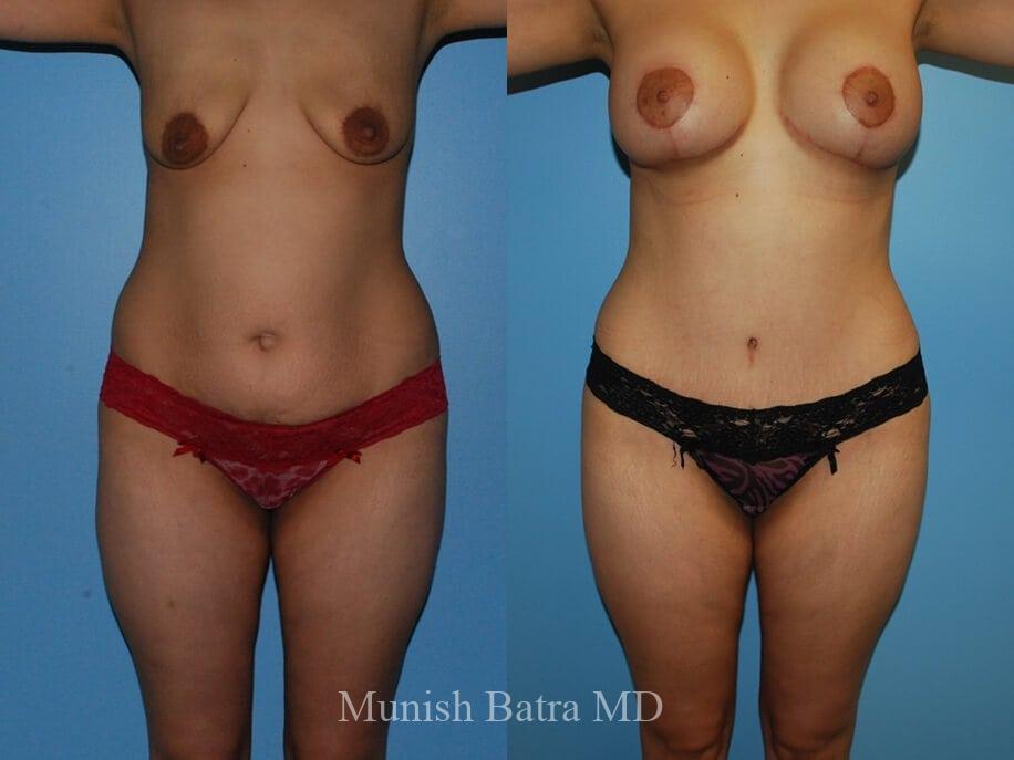Before and After Image