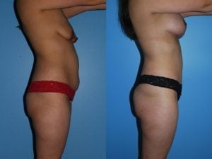 Before and After Image
