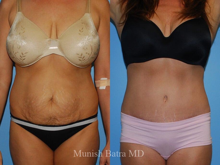 Before and After Image