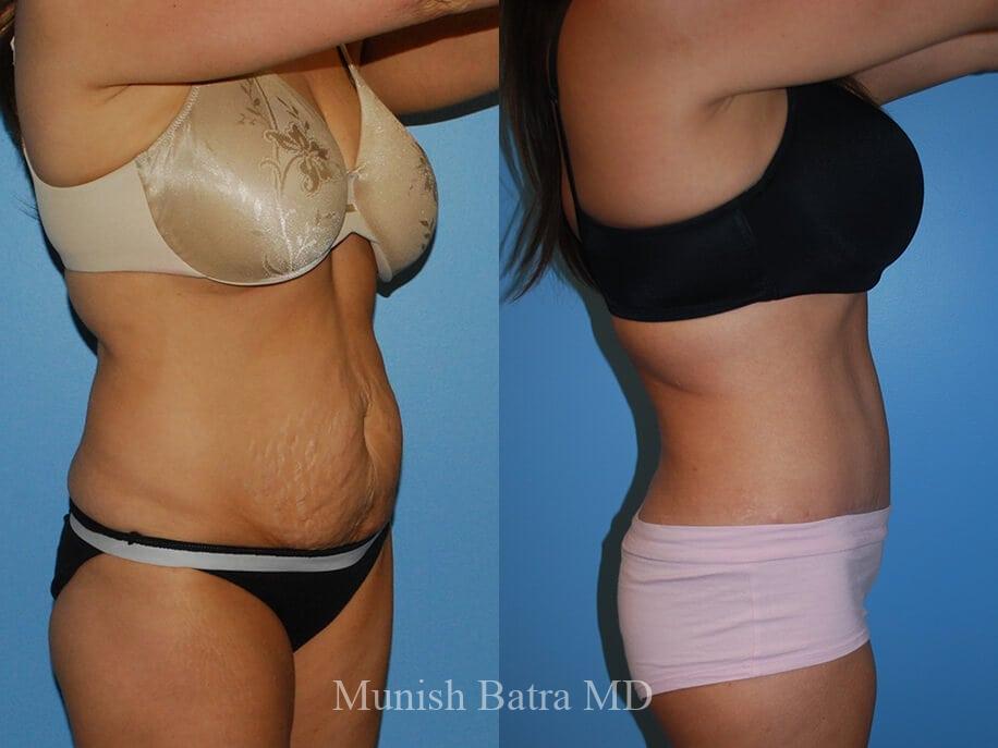 Before and After Image