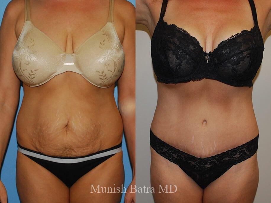Before and After Image
