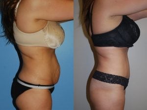 Before and After Image