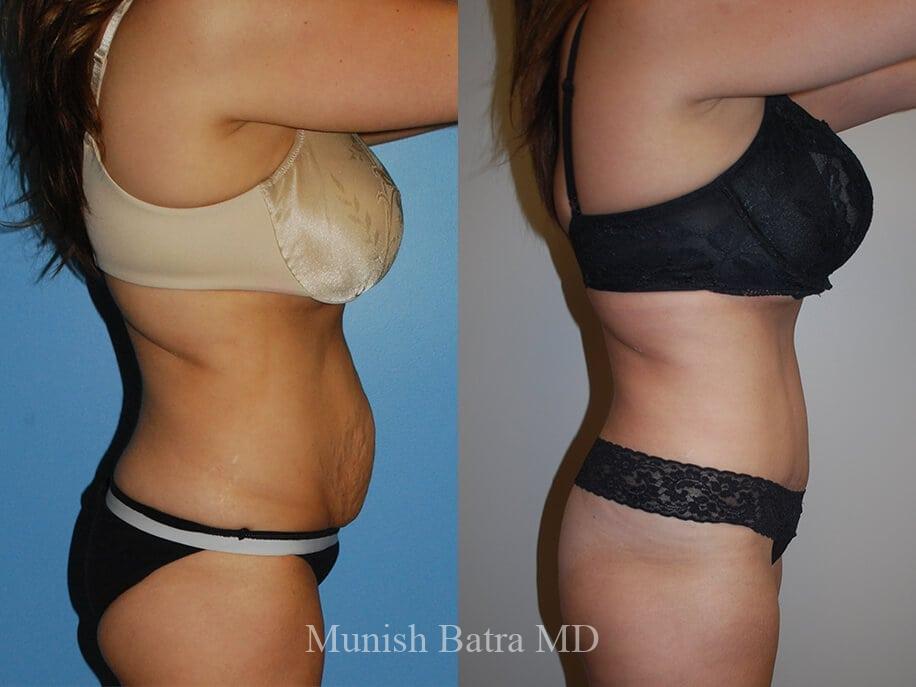 Before and After Image