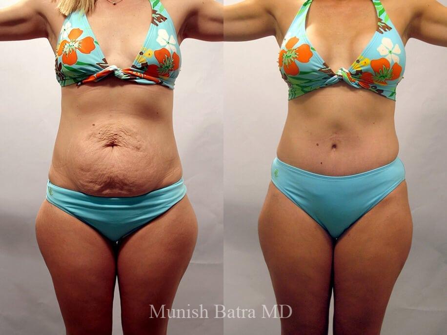 Before and After Image