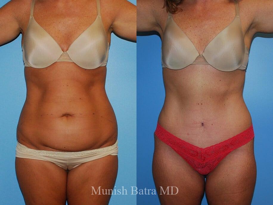 Before and After Image