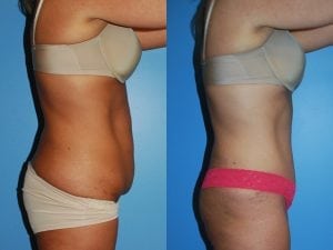 Before and After Image