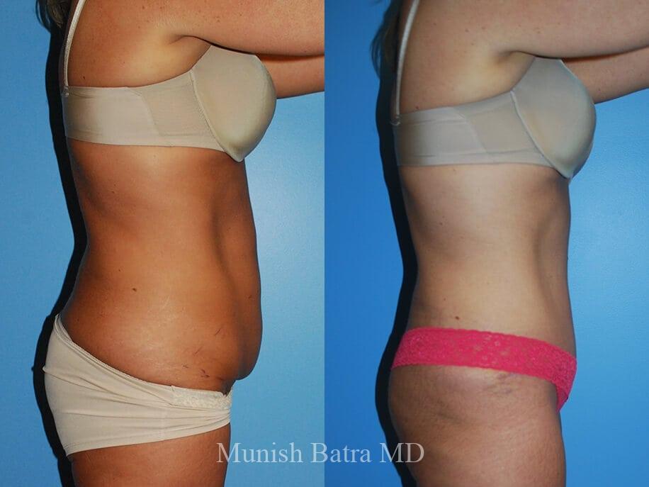 Before and After Image