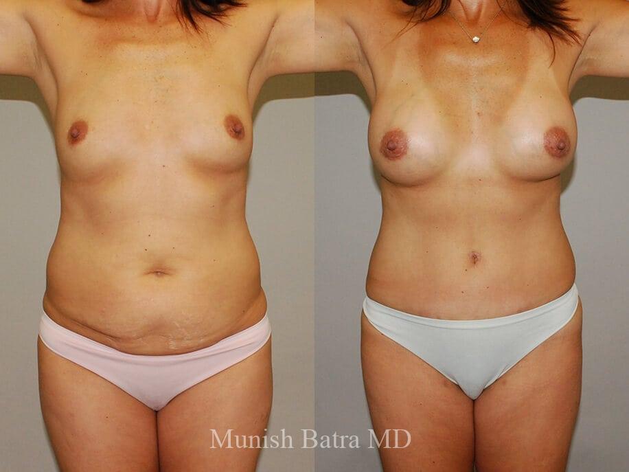 Before and After Image