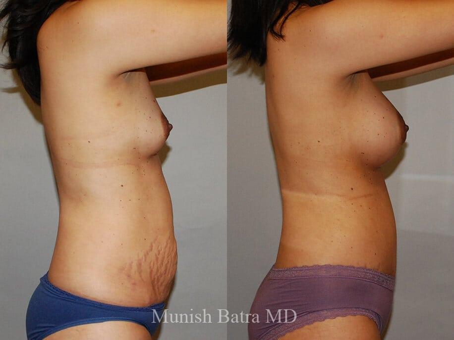Before and After Image