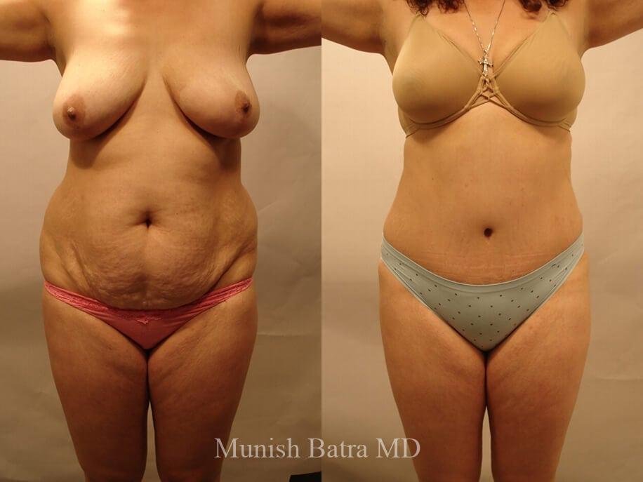 Before and After Image
