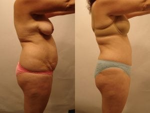 Before and After Image