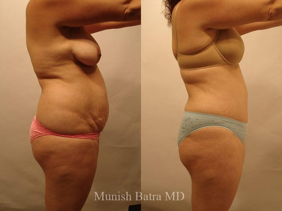 Before and After Image