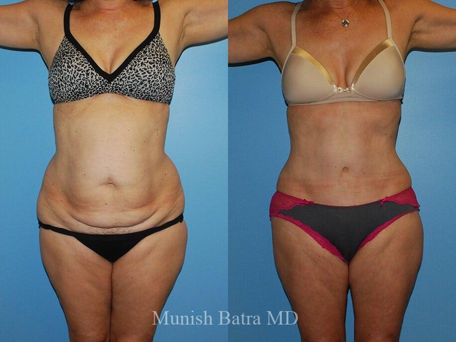 Before and After Image