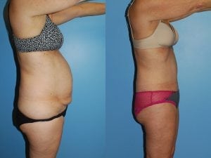 Before and After Image
