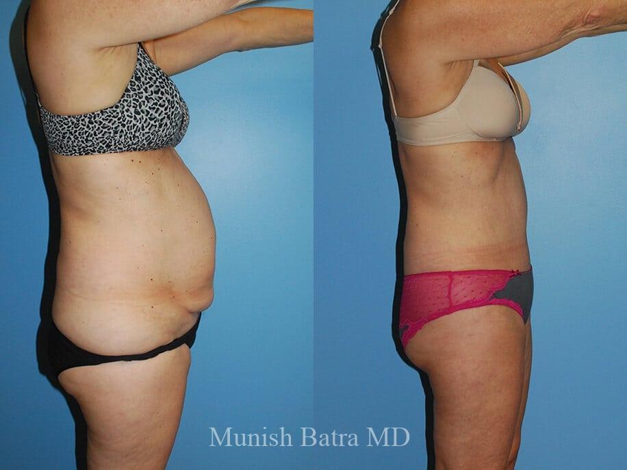 Before and After Image