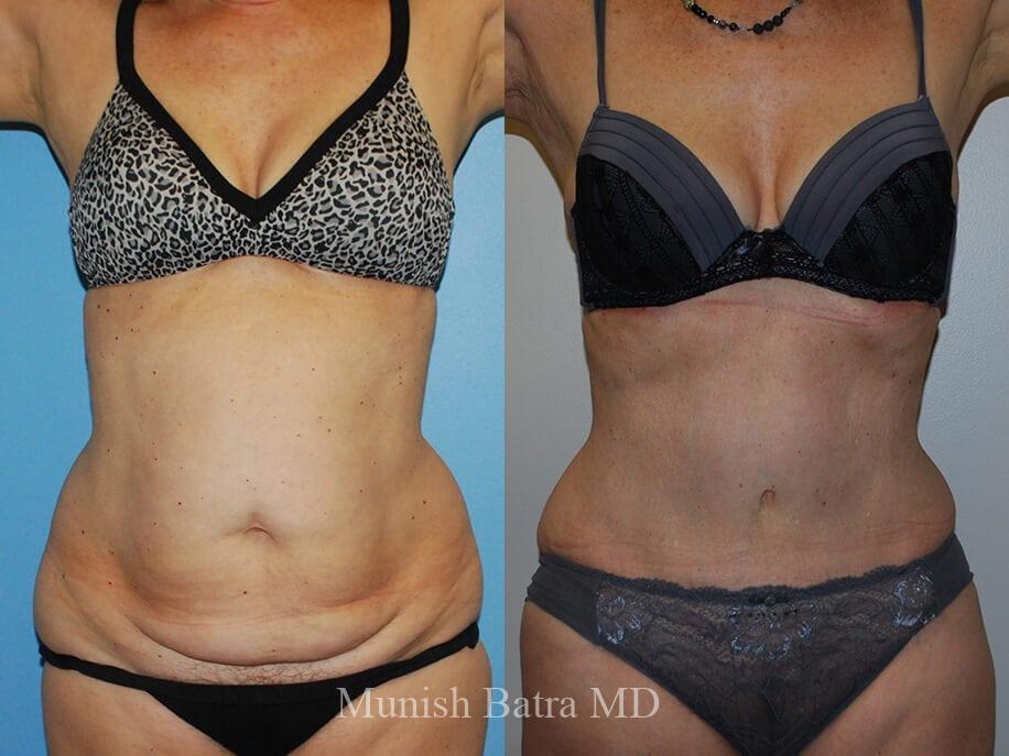Before and After Image