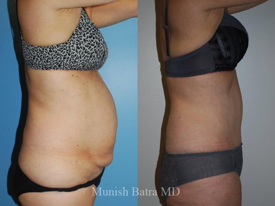 Before and After Image