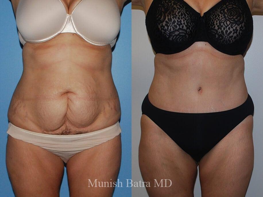 Before and After Image