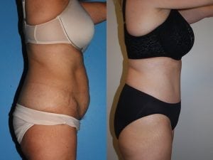 Before and After Image