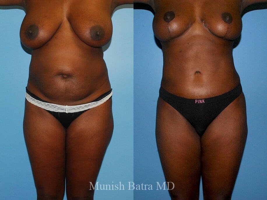 Before and After Image