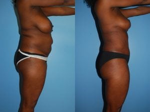 Before and After Image
