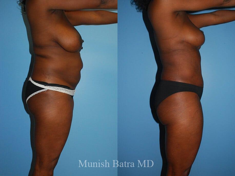 Before and After Image