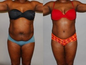 Before and After Image