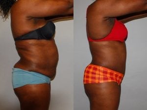 Before and After Image