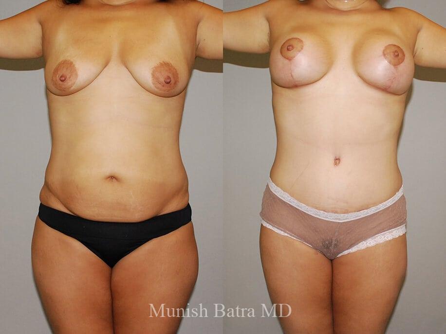 Before and After Image