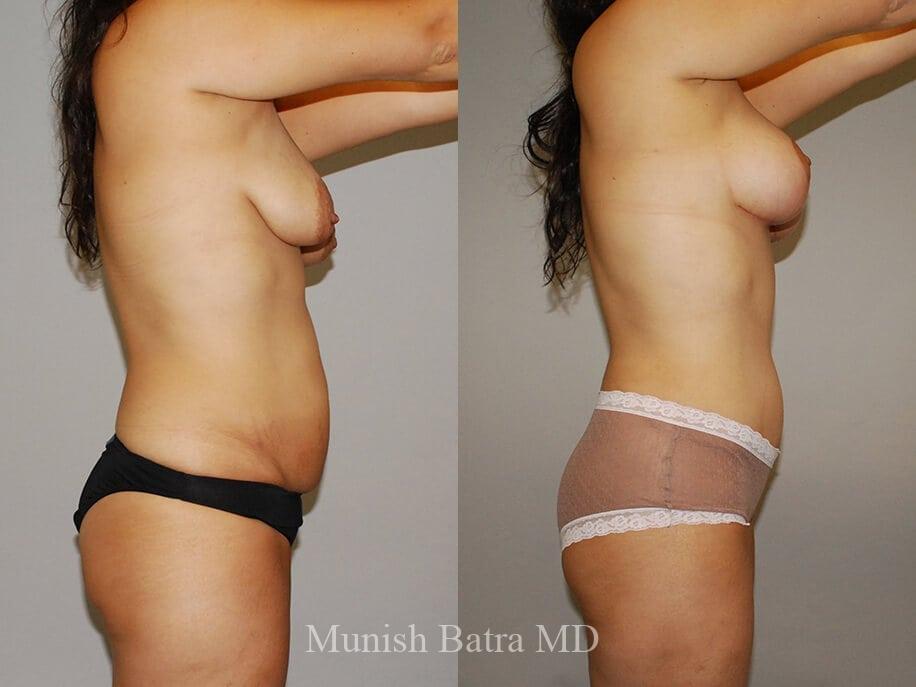 Before and After Image