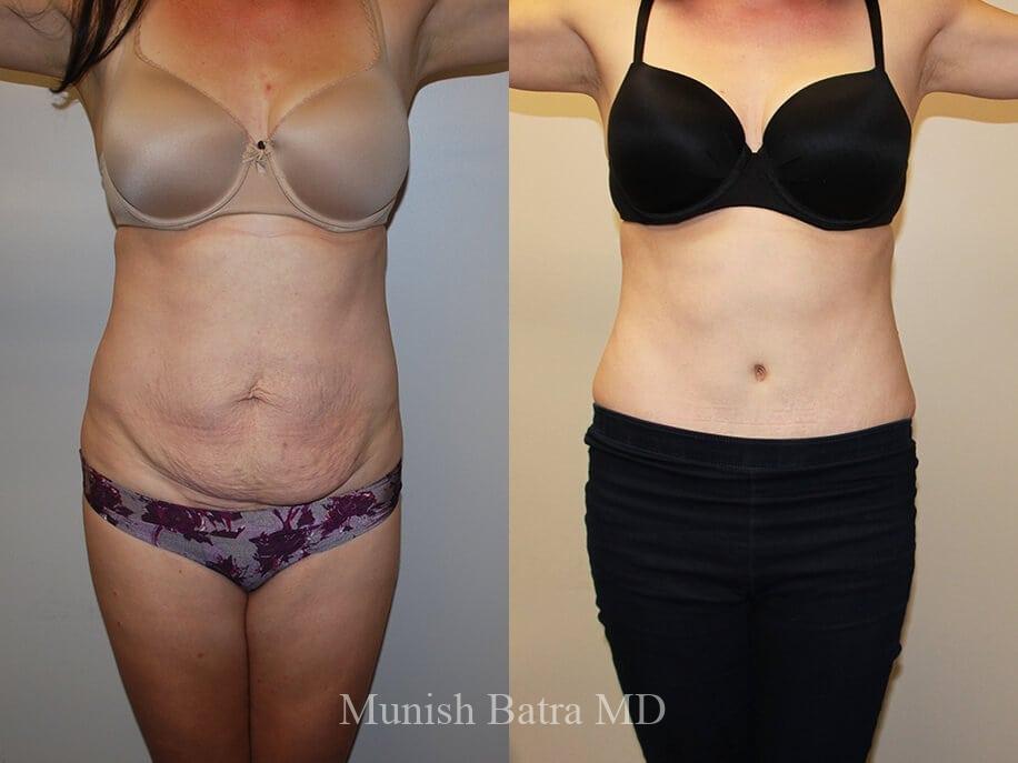 Before and After Image