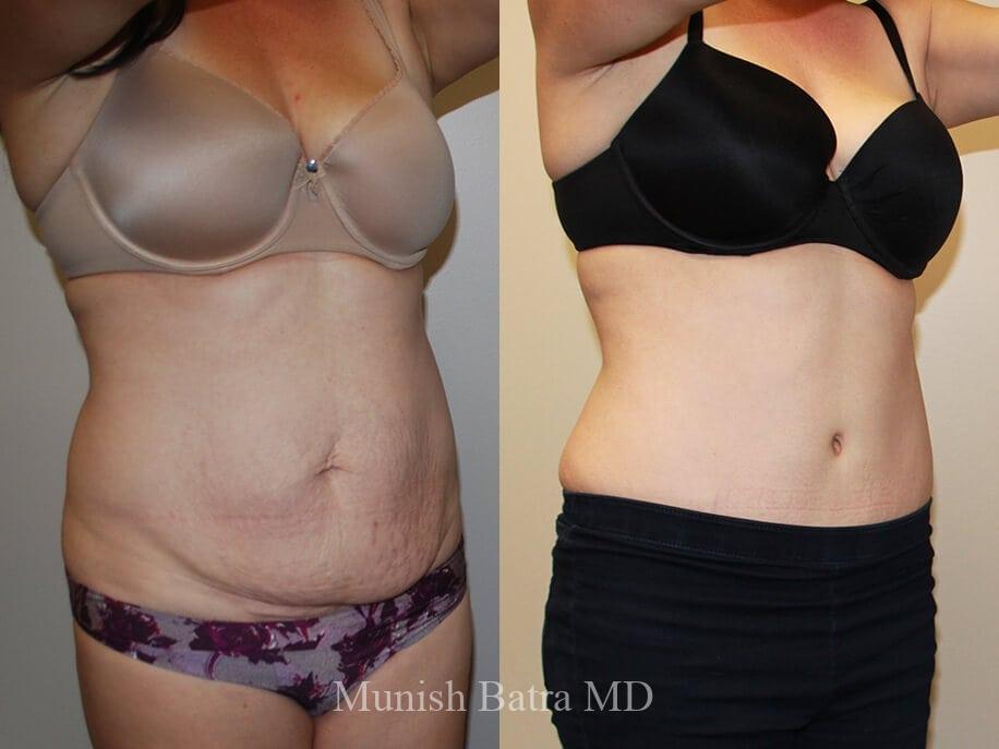 Before and After Image