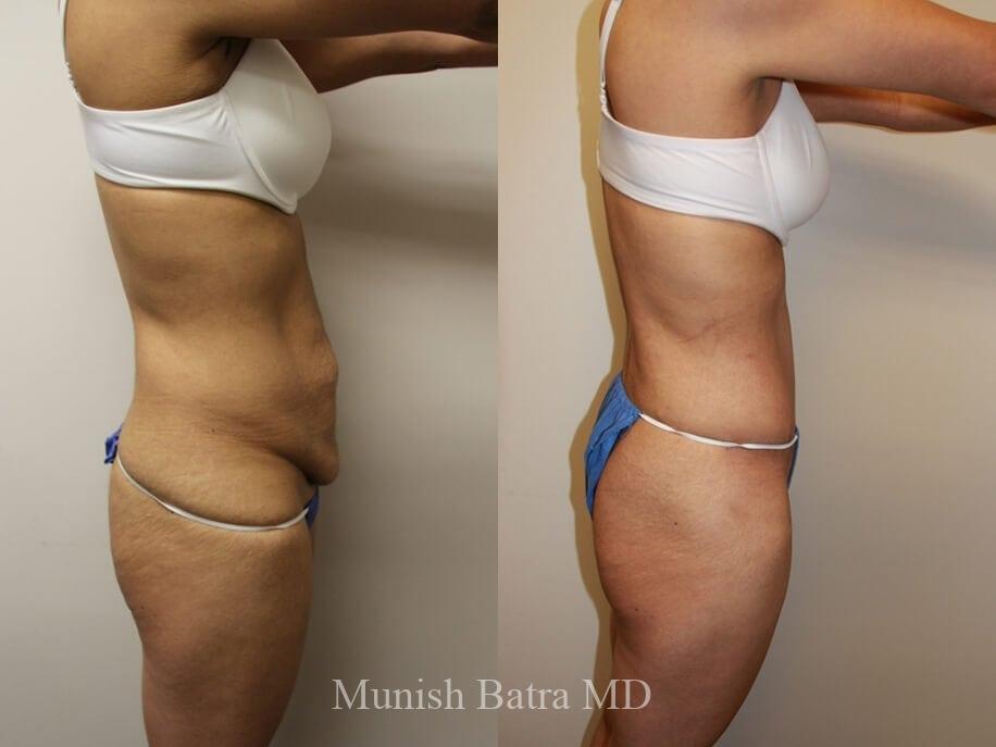 Before and After Image