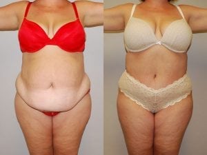 Before and After Image