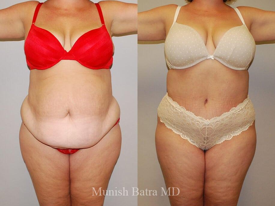 Before and After Image