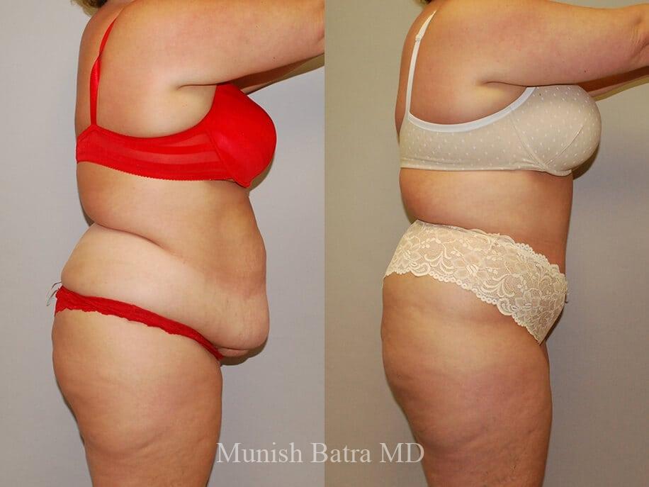 Before and After Image