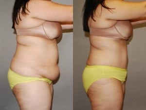 Before and After Image