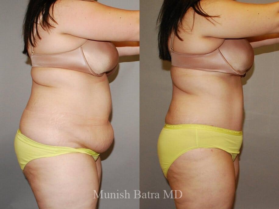 Before and After Image
